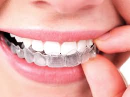 Since they're made of plastic, invisalign trays cause less irritation on the cheeks and tongue. Can You Wear Invisalign With Dental Crowns