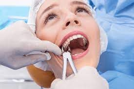 surgical tooth removal extraction