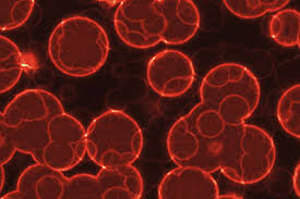 Unexplained Leukocytosis Thrombocytosis In Mpn Warrants
