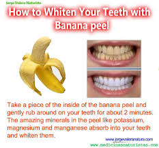 homemade teeth whitening with banana