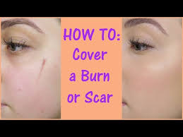 how to cover a scar with makeup you