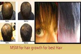 is msm good for hair growth styles