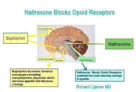 naltrexone stops alcohol cravings dr lipman