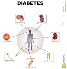 Diabetes Treatment Flow Chart