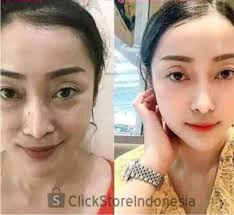 Benton aloe bha skin toner · 3. Paket Skincare Korea Skin Care Perawatan Pemutih Wajah Glowing Untuk Cowok Pria Wanita Remaja Bpom Shopee Indonesia