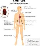 Image result for icd 10 code for cushing's syndrome