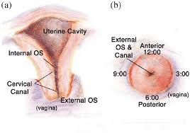 a cross sectional view of the cervix
