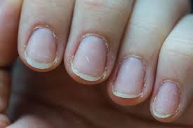 suffer from brittle nails returning
