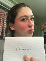 Roast my sister who didn't know she was allergic to cucumbers. : rRoastMe