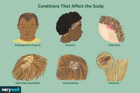 scalp conditions causes treatment