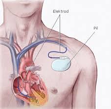Kalp sürekli çalışırken kasılır ve damarlara basınç uygular. Ritim Bozukluklari Prof Dr Ahmet Alpman
