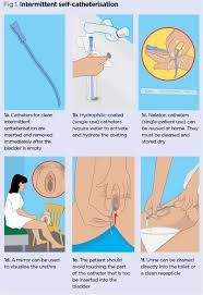 Urinary Catheters 4 Teaching Intermittent Self