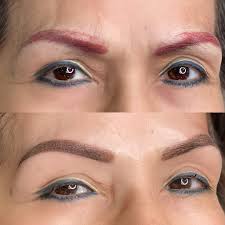 microblading cles tattoo removal