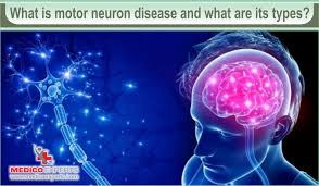 motor neuron disease treatment in india