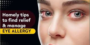 seasonal eye allergy homely tips to