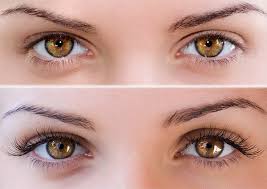 Latisse eyelash growth serum has the effective therapeutic result for sparse eyelash. Latisse Eyelash Serum East Valley Ophthalmology