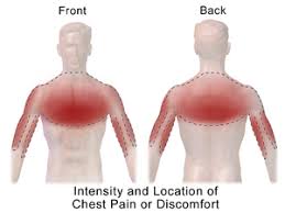 Chest breathing can make you want to try things that are unrealistic to impossible. Chest Pain Wikipedia
