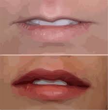 top 5 treatment options for thin lips