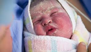 newborn skin ling causes treatment