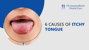 6 possible causes of itching on tongue