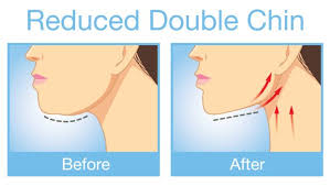 how to get rid of a double chin 5 easy