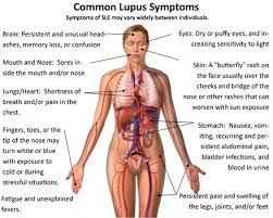 lupus stemcellreference