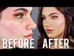 cover acne with makeup