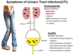 Urinary tract infections and dementia  A case study    sue croft    