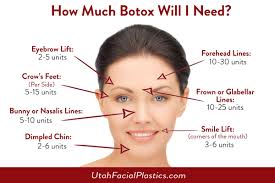 Botox Unit Diagram Botox Injection Sites Forehead Botox