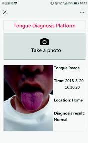 A Deep Learning Approach For Tongue Diagnosis Springerlink