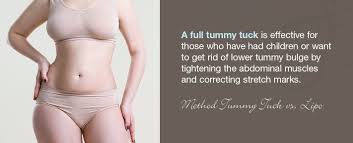 tummy tuck vs liposuction which to