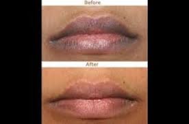 what causes dark lips
