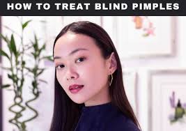 blind pimple treatment comprehensive