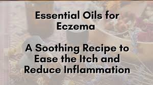 essential oils for eczema a soothing
