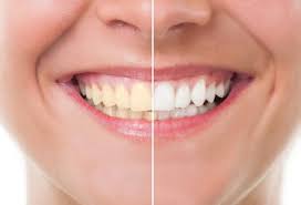 deep cleaning teeth cost how much