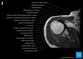 This mri knee cross sectional anatomy tool is absolutely free to use. Medical Imaging And Radiological Anatomy X Ray Ct Mri Kenhub