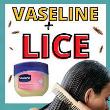 vaseline for lice does it work