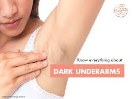 dark underarms treatment causes and