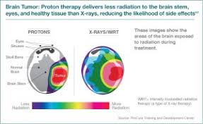 advantages of proton therapy
