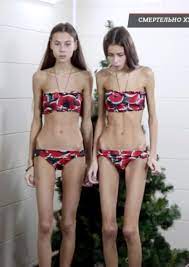 Teen catwalk stars turned into anorexic 'living corpses' after being 'told  to lose weight' by modelling school show off remarkable recovery | The  Irish Sun