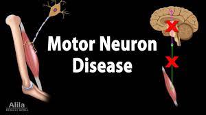 motor neuron disease animation you