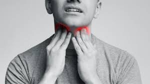 The appearance of throat cancer may vary depending on the stage. Throat Cancer On The Rise And Not In Smokers Or Tobacco Users