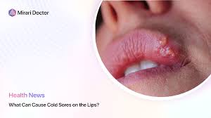 what can cause cold sores on the lips