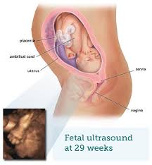 Fetal Ultrasound 6 Months Babycentre Uk