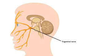 cure of trigeminal neuralgia