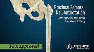proximal fem nail antirotation