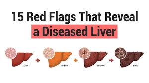 red flags that reveal a diseased liver