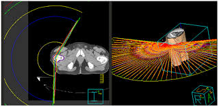 the future of image guided radiotherapy