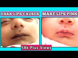 baby lips black after feeding the