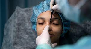 mental health effects of plastic surgery